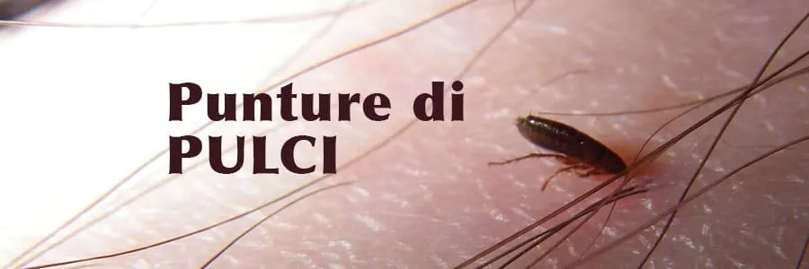 Al momento stai visualizzando Punture di pulci | Ecco come possiamo riconoscerle
